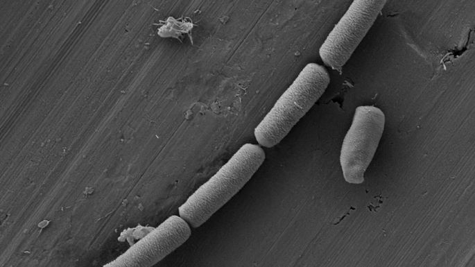 Bacteria Cimento