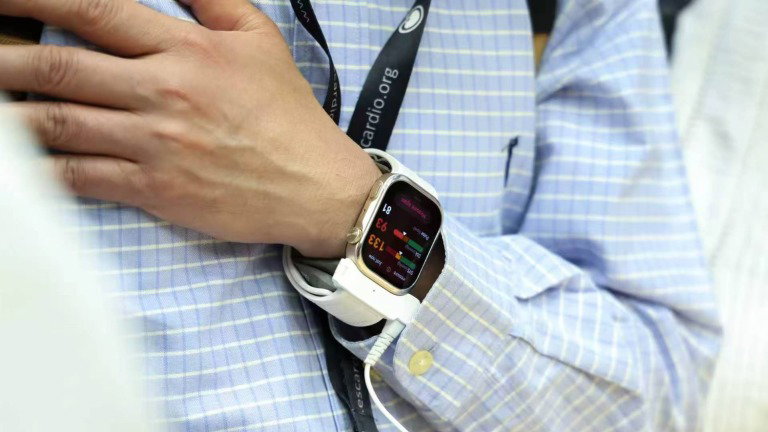 Huawei revela novo smartwatch que tem o que a Apple e a Samsung não têm