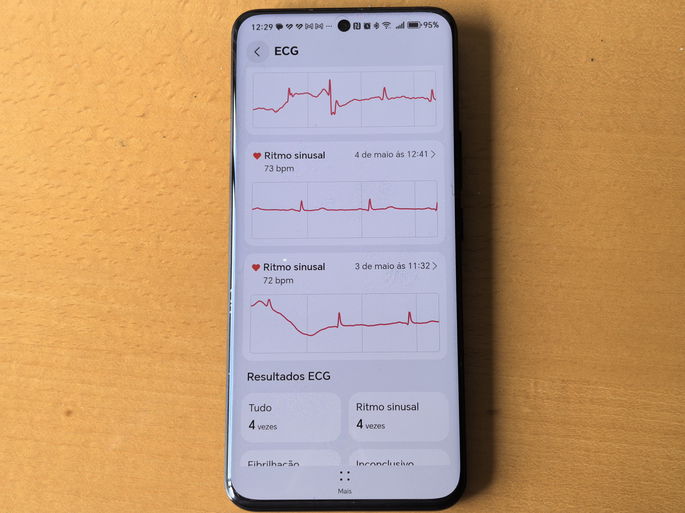 ECG na app Huawei Health