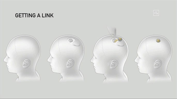 Neuralink