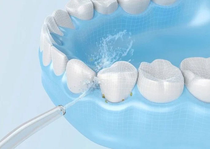 Xiaomi irrigador fio dental